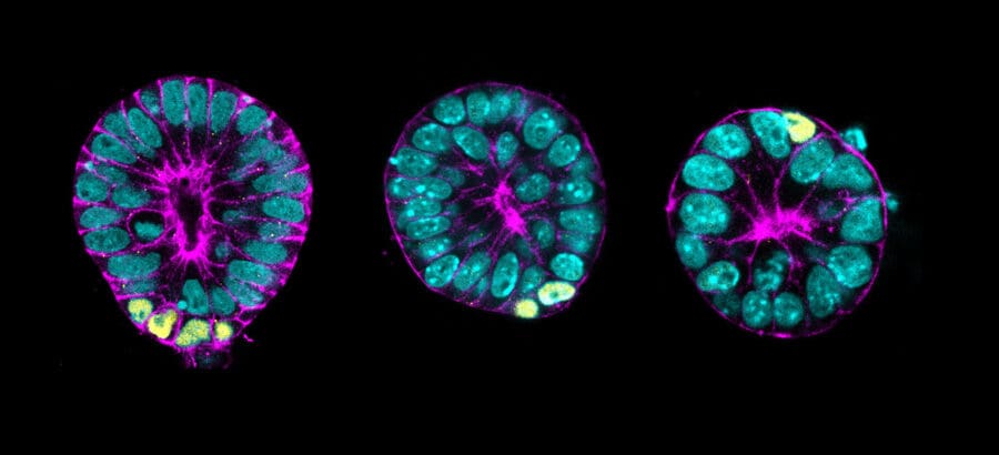 Fluorescent micrographs of three multicellular spheroids showing teal nuclei, magenta cell membranes, and distinct yellow cells.