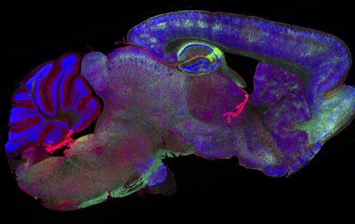 Fluorescently tagged brain