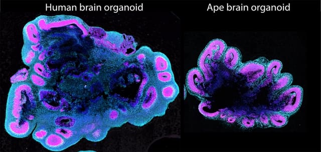 A colourful image of brain organoids showing protrusions of different layers of cells in cyan and magenta. On the left is a human organoid which is larger than the one on the right, which is an ape organoid.