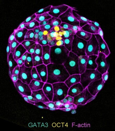 The image shows a human embryo in which the different cell lineages have been marked with different colours, and the cell shapes are demarcated.