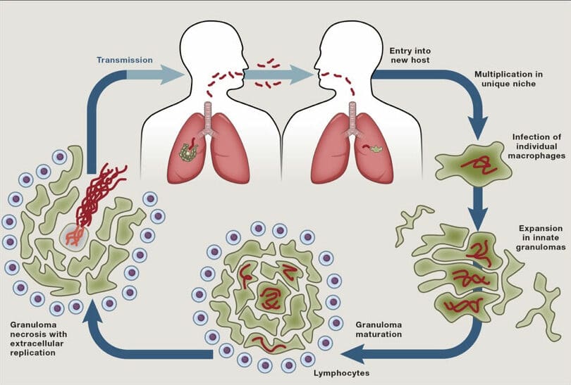 Coloured flow diagram showing cycle of Mtb entry into human host, developing granuloma, breakdown of the granuloma and transmission to a new human host.