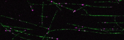 Magenta ribonucleoprotein complexes are seen localised along and associated with green cellular filaments in a fluorescence micrograph.