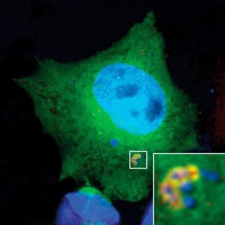 Mammalian cell with blue nucleus and green cytoplasm exhibiting multi-colored cytoplasmic puncta; magnified view shows intricate organization.