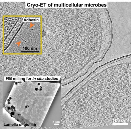 In situ structural studies of multicellular microbes