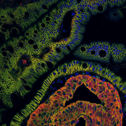 Fluorescent micrograph of developing tissue features blue nuclei, green/yellow cell membranes, and red-orange differentiated cells forming tubular structures.