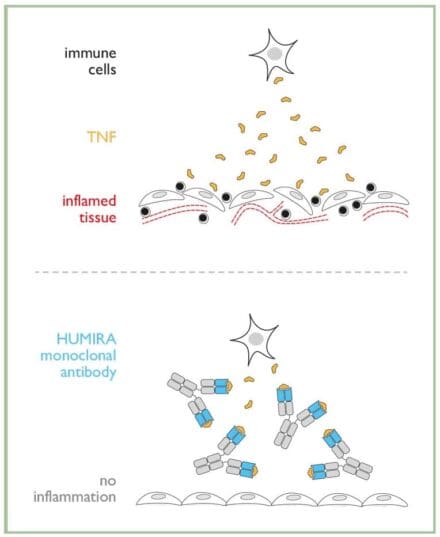 Diagram with two images, one showing the inflamed tissue and the other image showing Humira preventing inflammation