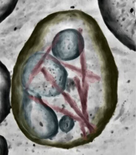 Denoised tomographic volume and segmentation from electron cryotomography of a brain extracellular vesicle from an individual with Alzheimer's disease, showing tau filaments tethered to the luminal side of the limiting membrane. The vesicle also contains internal vesicles