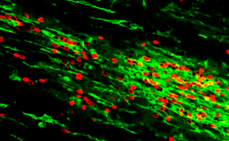Fluorescent image of cells