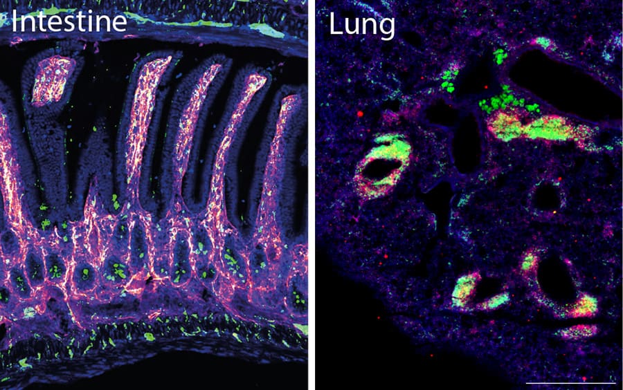 Immunofluorescence images of intestine and lung. Lymphatic vessels (purple) and neurons (green) in the mouse intestine. Ectopic tertiary lymphoid structure (iBALT) formation (B cells (green), T cells (red)) during chronic allergic lung inflammation in LIF-deficient mice