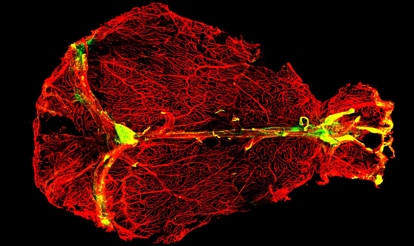 Antibody-producing plasma cells line the dural venous sinuses