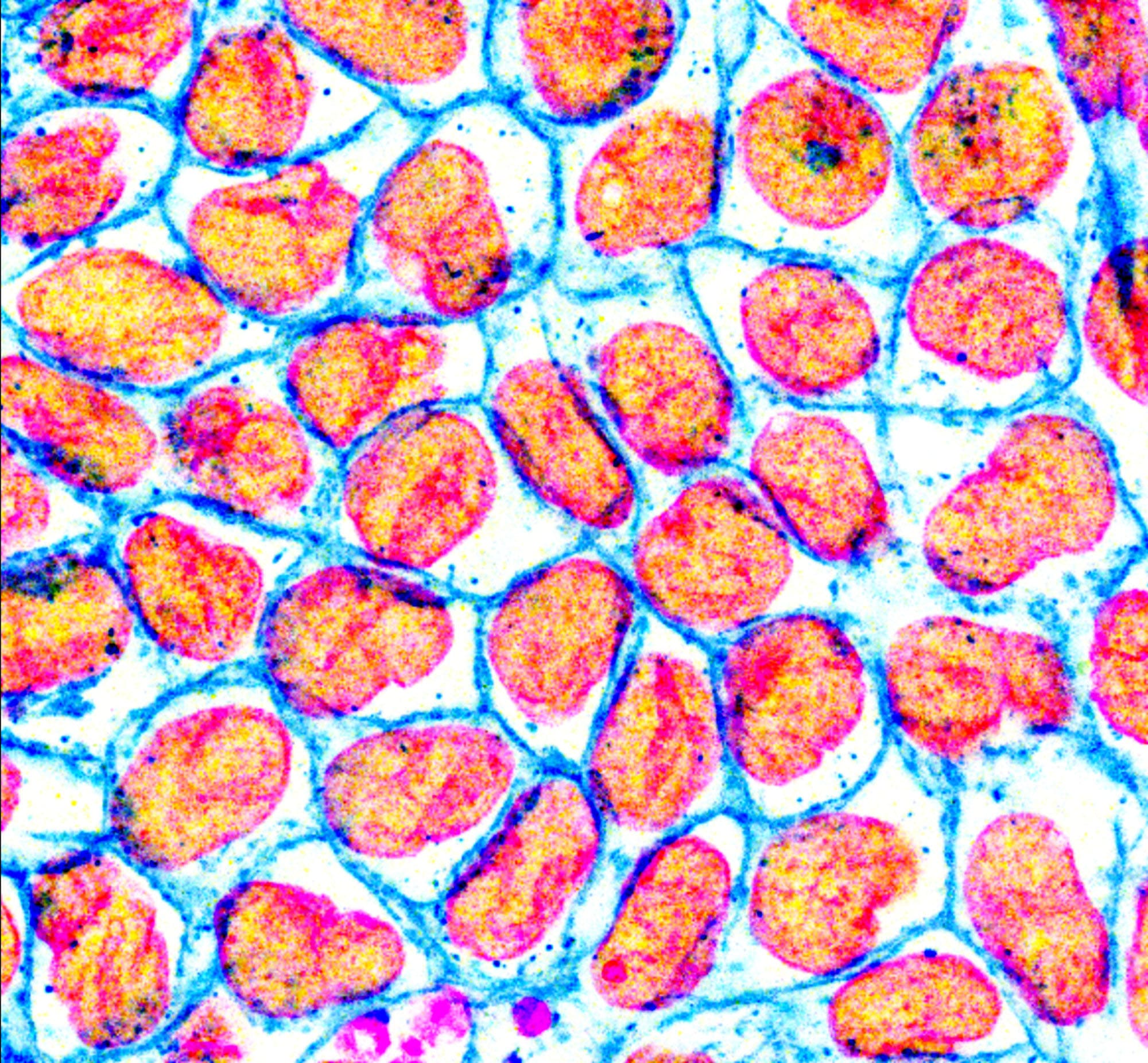 Caco2 tight junctions