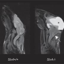 Fanconi Anaemia Research