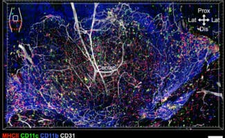 Spatial distribution of MHCII+, CD11c+, CD11b+ immune cells and CD31+ vasculature within a complex kidney tissue microenvironment.