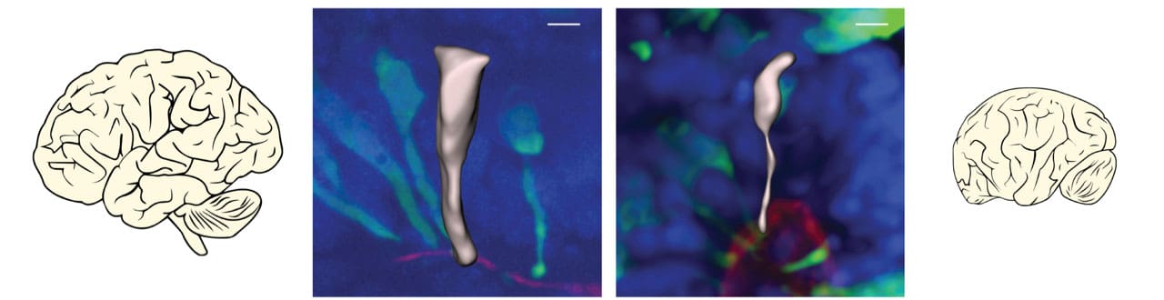 Human and ape neural progenitors