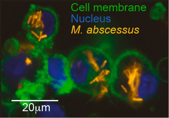 M. abscessus infection of human macrophage cell line (THP1) imaged through high content microscopy