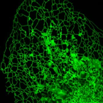 Endoplasmic Reticulum