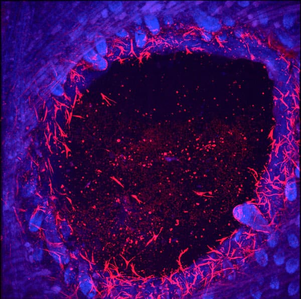 Fibroblasts invading a wound