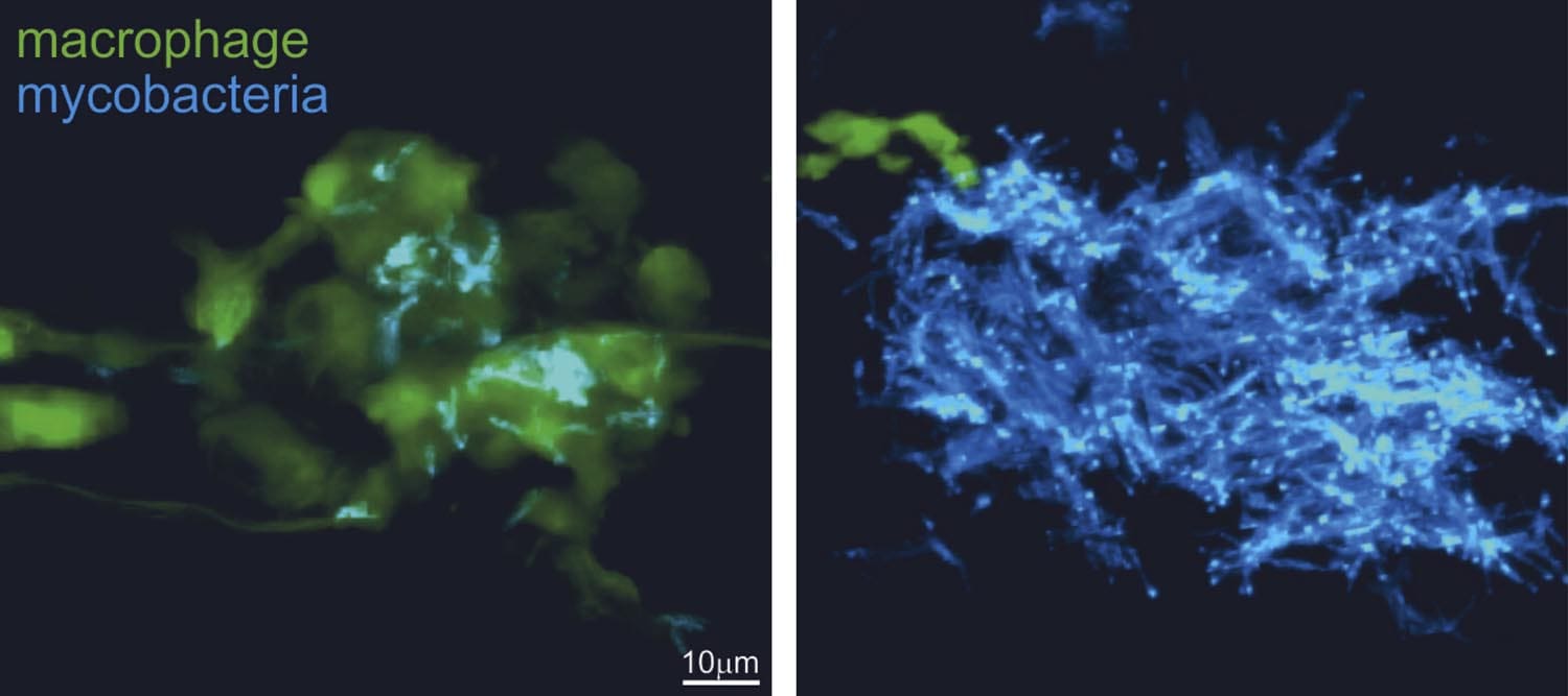 Zebrafish granulomas in wild-type (left) and excess TNF (right) conditions, showing loss of a cellularity and exuberant extracellular bacterial growth as a result of macrophage death by TNF-mediated mROS.