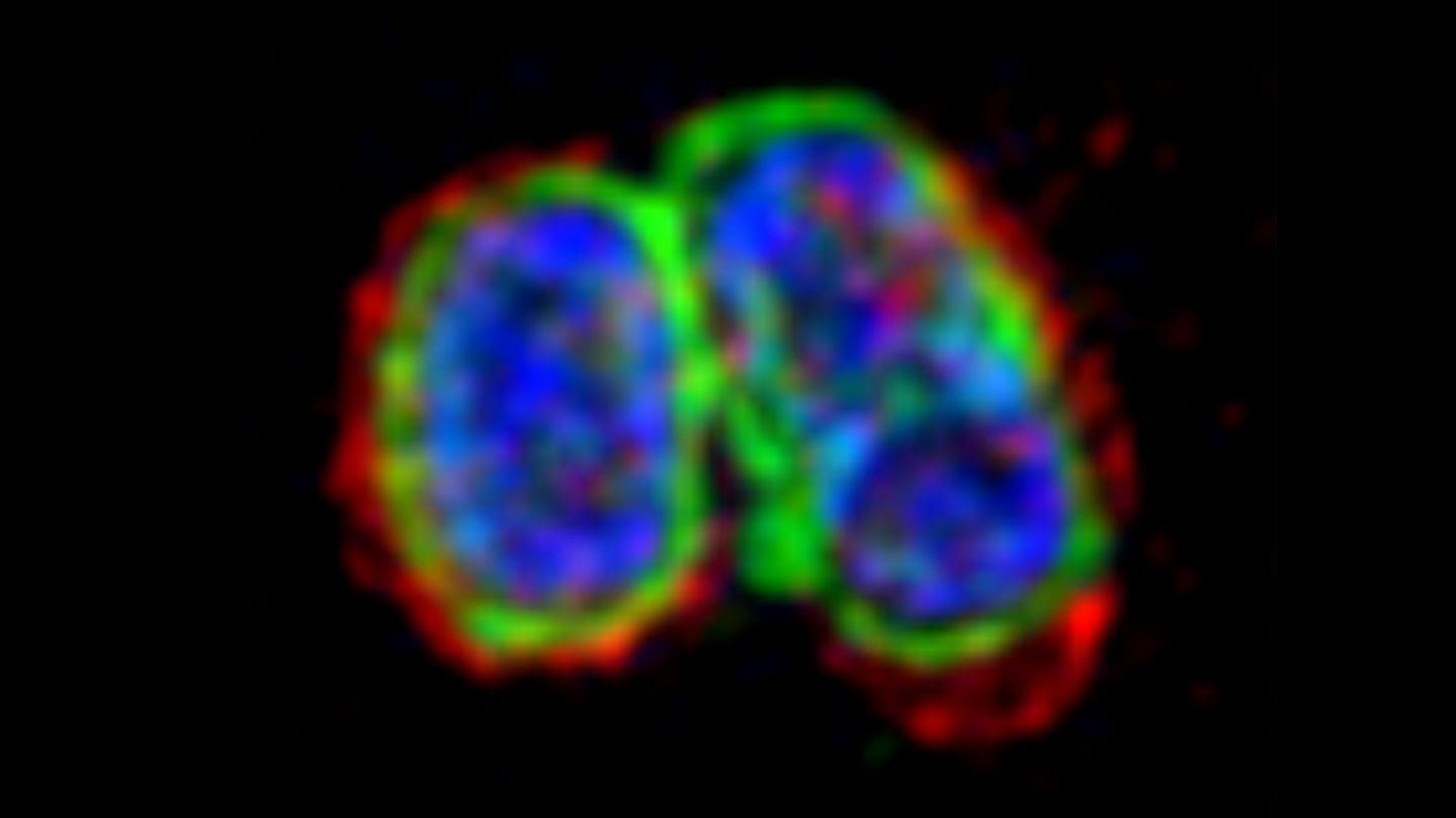 Superresolution image of Salmonella Typhimurium (blue) with its surface coated in a dense layer of GBPs (green) that serves as a signaling platform for the recruitment and activation of caspase-4 (red)