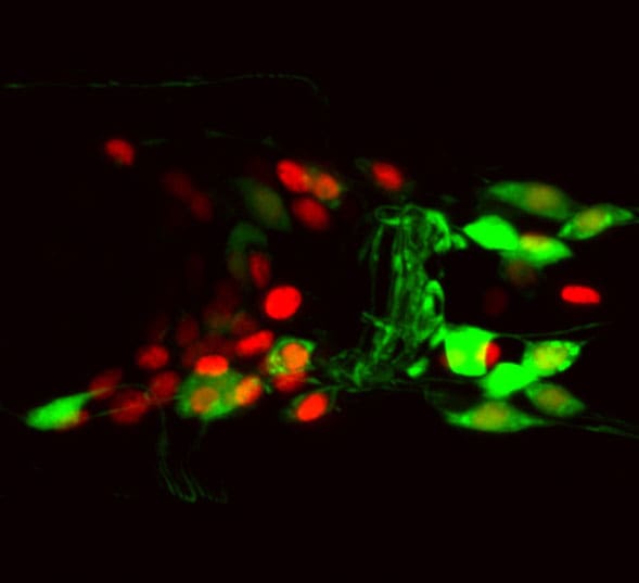Image of a nematode worm brain