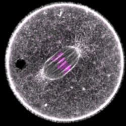 Schuh - Asymmetric Spindle Positioning