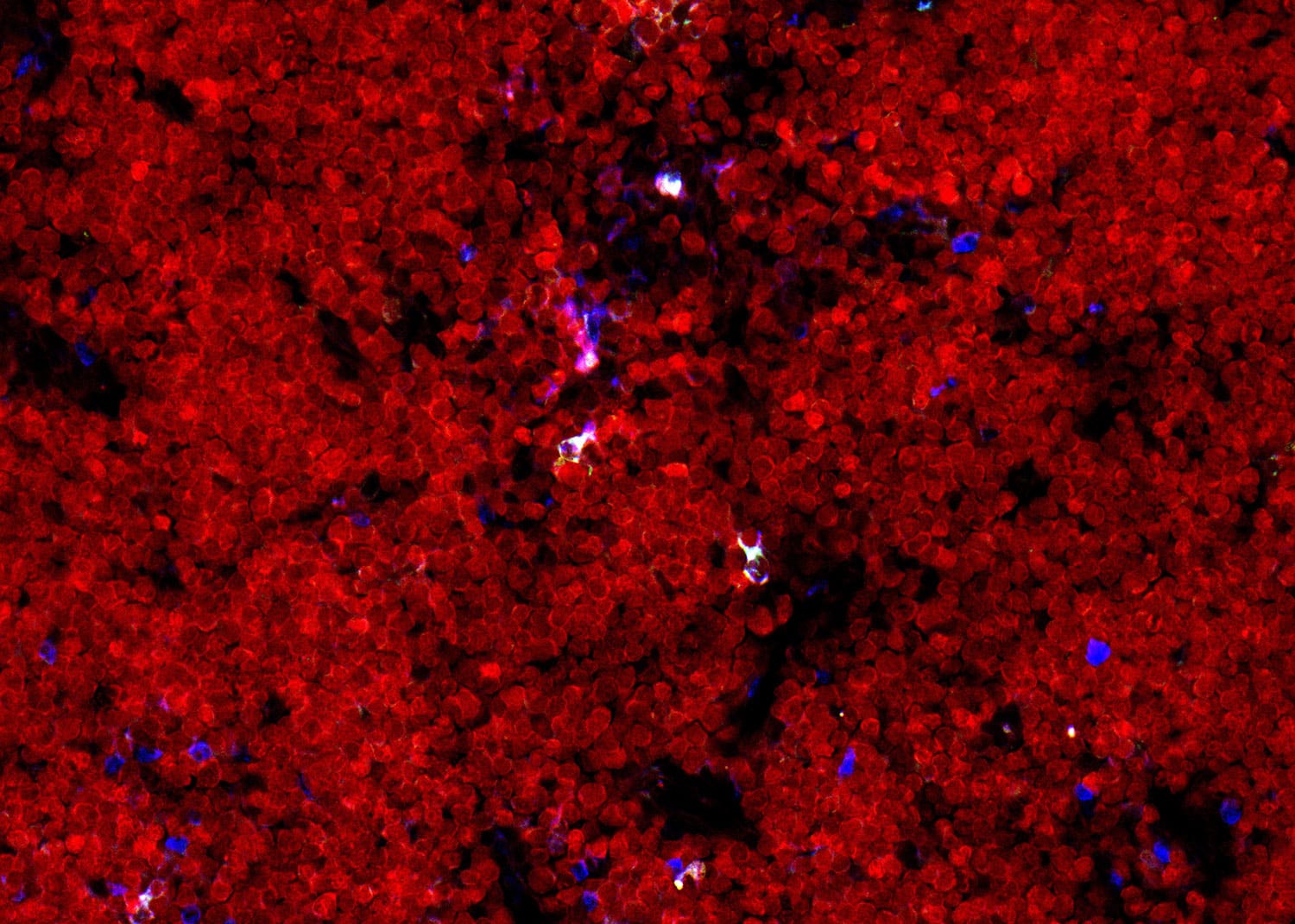 Early development of ILC2 in the embryonic thymus