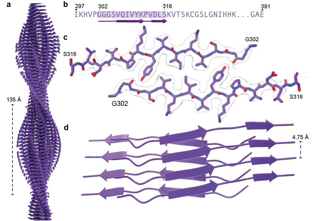 Images showing the structure of the FIA, including a side view of the twisted amyloid filament, amino acid sequence of the FIA ordered core, top view of the cryo-EM density and atomic model, and side view of the atomic model in schematic representation highlighting the presence of twisted antiparallel beta sheets. 