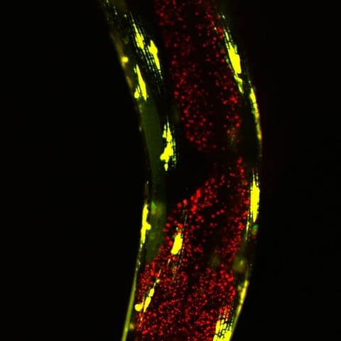 Disease-causing proteins and lysosomes in the body of a worm.