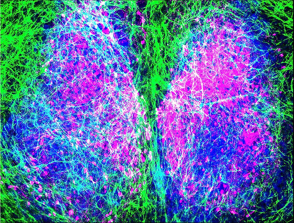 Composite image of astrocytes & neurons of the SCN