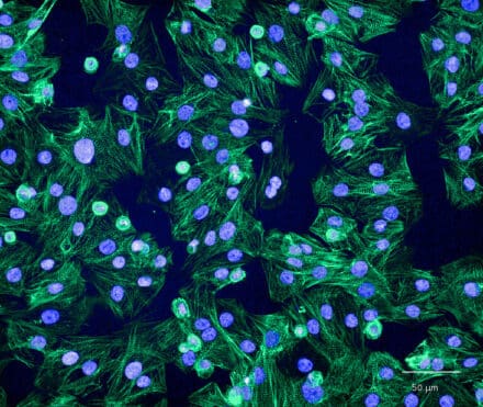 Spontaneously beating culture of cardiomyocytes stained for the contractile protein alpha-actinin (green) and nucleus (blue) Image courtesy of Linda Starnes, AstraZeneca R&D