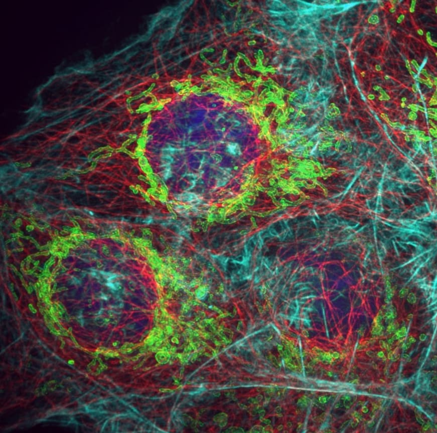 Light Microscopy Examples Light Microscopy | MRC Laboratory of Molecular Biology