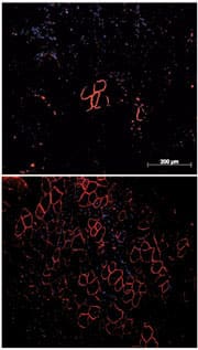 Dystrophin detection in mdx mouse muscle.