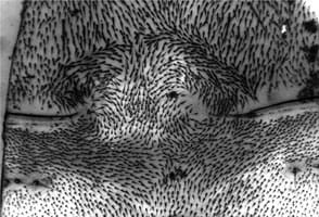 The pattern of bristles on the back of an insect; they mostly point backwards. In one region they point forwards and that patch is surrounded by bristle whorls with intermediate polarities