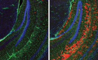 mouse brain fluorescence