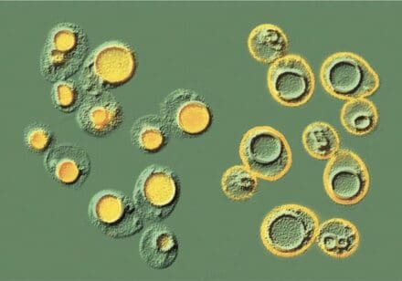 ): Image of yeast cells with yellow colour in the central round vacuole for cells on the left, or round the edge of the cells on the right